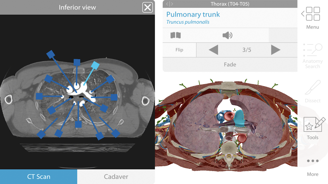 human anatomy atlas app reddit reveiw